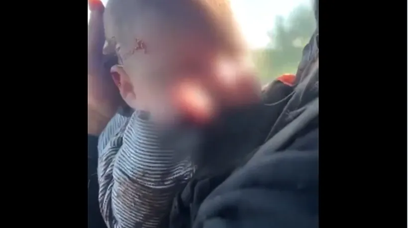 UPDATE | Război în Ucraina, ziua 629: Bombardamente ruseşti în regiunea Herson: 17 persoane au fost rănite, între care un bebeluș de doar două luni