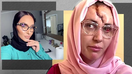 VIDEO | Imagini șocante cu Dana Roba, după ce a fost bătută de soțul ei! ”Nu-mi vine să cred cum am arătat și cum arăt acum”