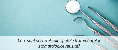 (P) Care sunt secretele din spatele tratamentelor stomatologice reușite?