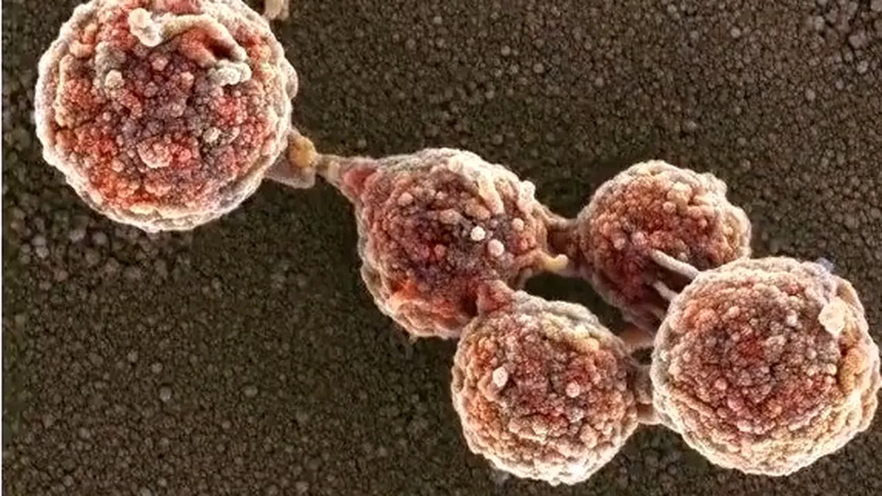 Premieră în știință: E. Coli sintetic, cel mai mare genom creat de la zero - VIDEO