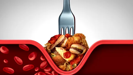 Cum îți poți scădea nivelul colesterolului FĂRĂ pastile