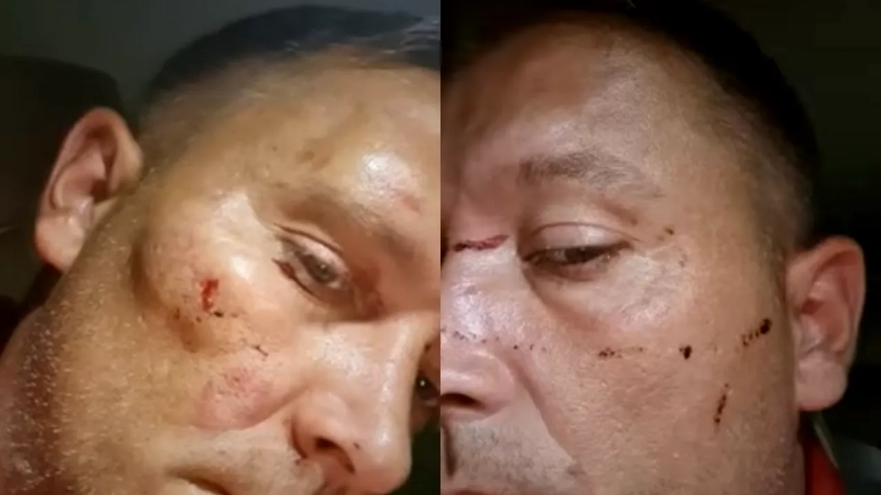 Bărbat, bătut cu bestialitate de trei indivizi când se întorcea de la un priveghi: „Siguranţa nu mai există”. Ce transmit autoritățile în urma atacului - VIDEO