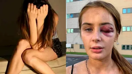 Tânără bătută crunt după ce a refuzat un bărbat. O singură replică l-a făcut să-și iasă din minți: „Îmi pare rău, dar nu sunt interesată...