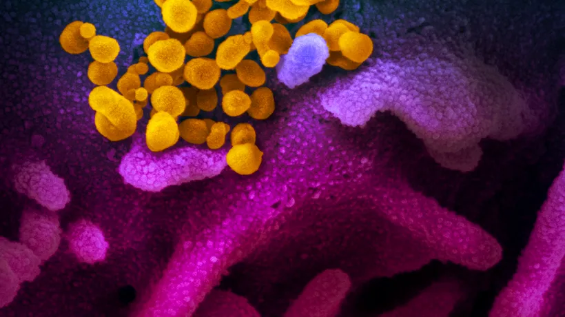 Primele imagini! Cum arată noul coronavirus la microscop