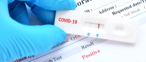 Un nou test pentru depistarea COVID-19 poate oferi rezultatul în doar 20 de minute. Cum funcționează acesta