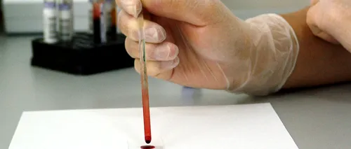 Cancerul ar putea fi depistat prin analiza unei singure picături de sânge