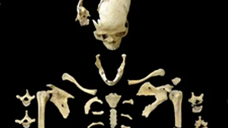 Cercetătorii germani au descoperit cel mai vechi caz de leucemie cunoscut de istorie. O femeie a avut boala în urmă cu 7000 de ani