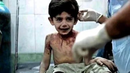O imagine controversată. Ultimele cuvinte ale un copil de 3 ani din Siria: 