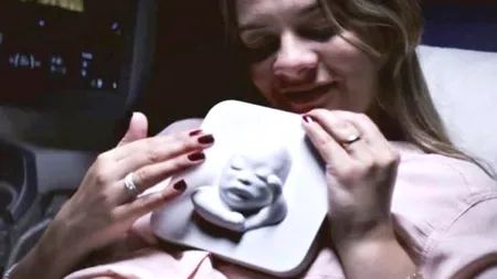 Moment emoționant: cum reacționează o femeie însărcinată oarbă când primește o ecografie personalizată a bebelușului