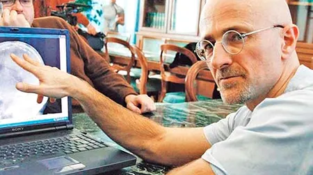 Un chirurg italian vrea să pună la cale o procedură controversată. Colegii săi sunt sceptici: „Nu cred că va funcționa, există prea multe riscuri