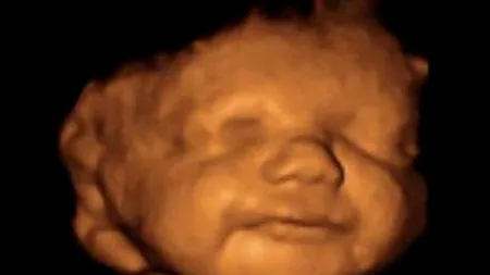 Povestea emoționantă a unui cuplu care a primit o veste teribilă: „Dincolo din lucrurile îngrozitoare care mi s-au povestit, era datoria mea de mamă să îl protejez