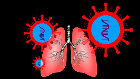 Alen Stegaru, medic primar radiolog: ”Nu e util ca pacientul COVID pozitiv să fie tratat acasă“