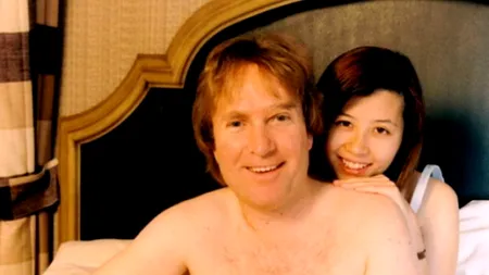 Un bărbat din SUA trăiește de 17 ani cu silicoane: 