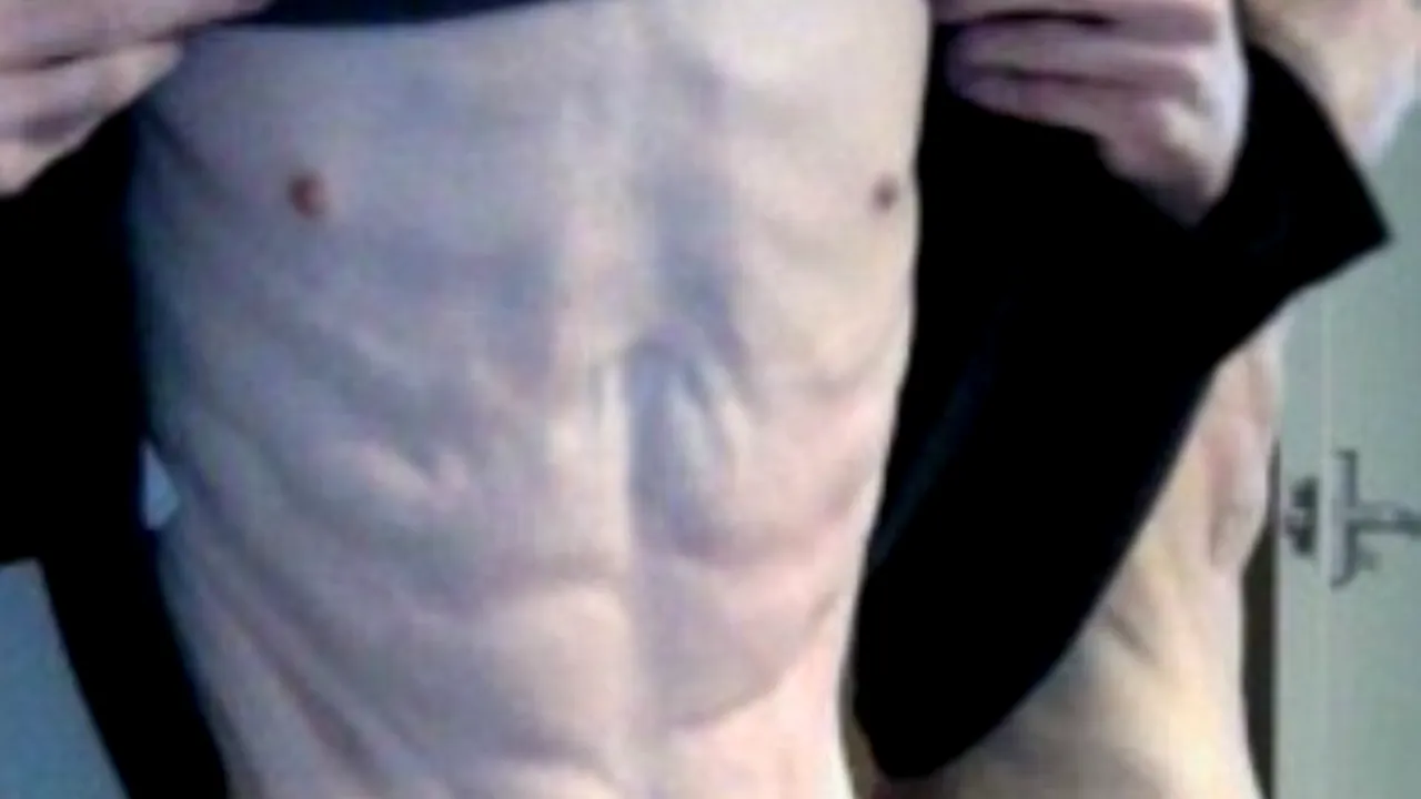 După ce a ajuns să cântărească 34 de kg, un tânăr care suferea de anorexie și-a învins tulburarea și a devenit antrenor personal și model. FOTO înainte și după