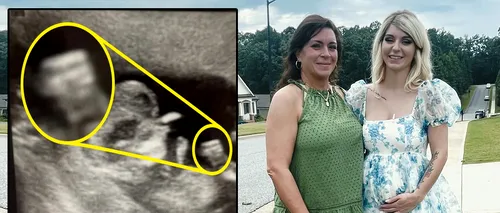 Această femeie gravidă a rămas mască după ce a făcut o ecografie. Detaliul BULVERSANT observat în această imagine
