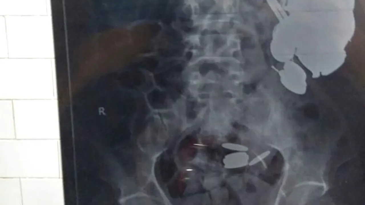 A mers la spital acuzând „dureri inimaginabile