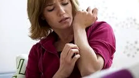 De ce scărpinatul sporește mâncărimile, în loc să le calmeze