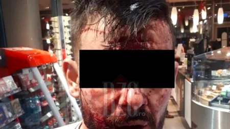 Răzbunare din gelozie: Și-a tăiat iubita pe față și l-a obligat pe actualul concubin al femeii să reproducă scene din filmele pentru adulți, în fața unei benzinării!