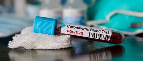 Bilanț coronavirus: 4.041 de noi cazuri de COVID-19 în ultimele 24 de ore în România. Încă 86 de oameni au murit din cauza SARS-CoV-2