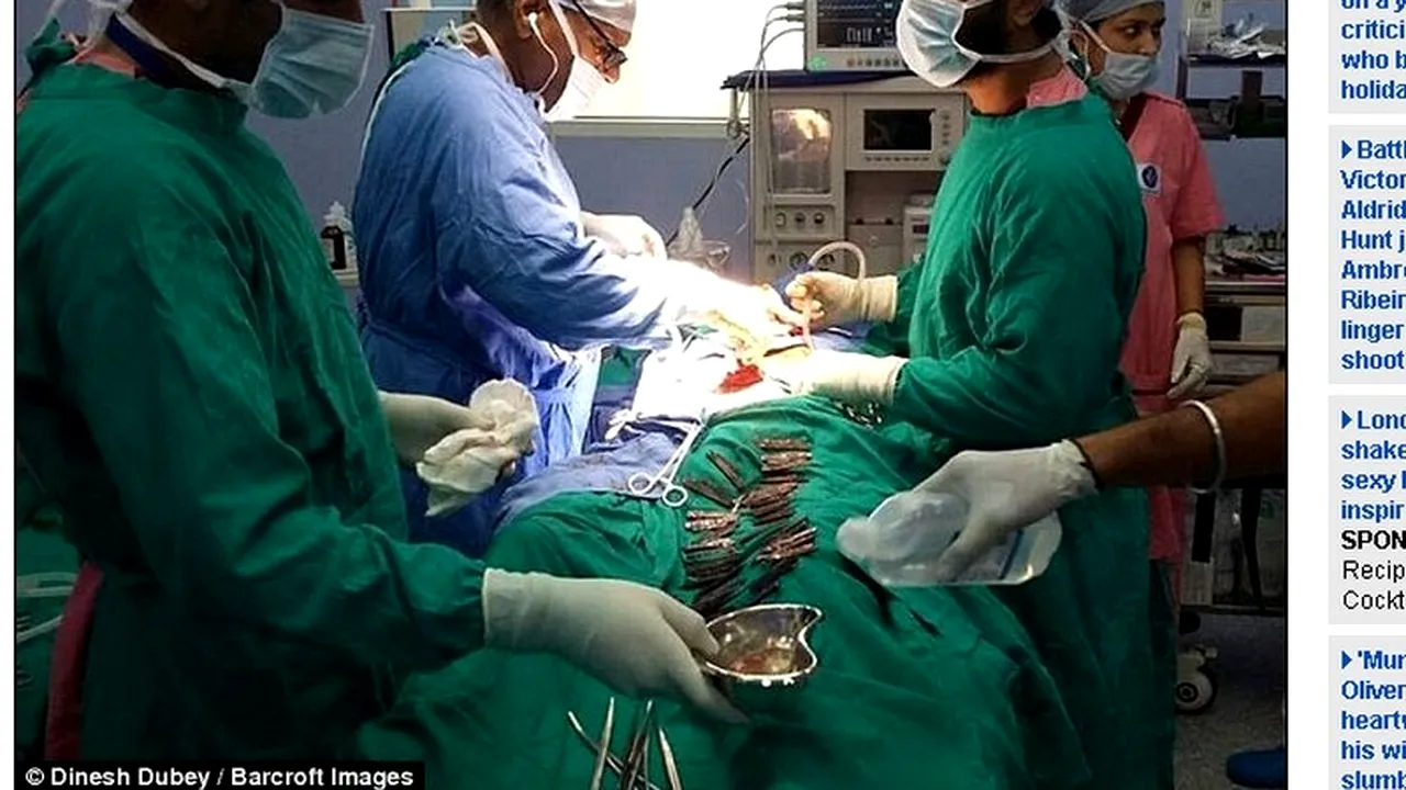 Medicii credeau că are o tumoare uriașă, dar el ascundea altceva în stomac: ''N-am mai văzut așa ceva''