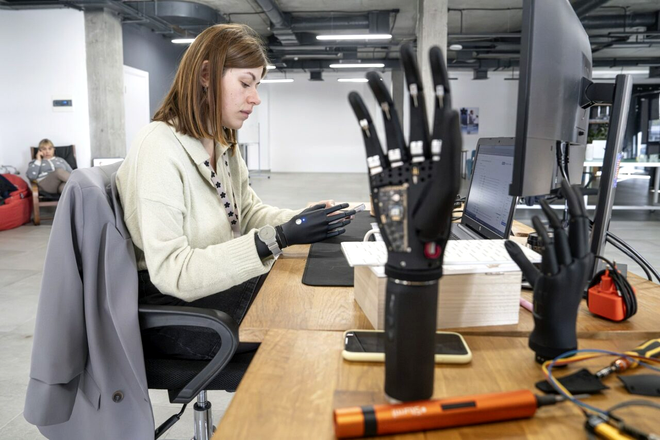 Olena Pozniakova, o femeie ucraineană în vârstă de 28 ani, este inginer de asigurare a calității și testează aplicația pentru protezele bionice la biroul Esper Bionics din Kiev. 70% din membrele bionice ale companiei americane sunt fabricate în Ucraina Sursa Foto: Profimedia 