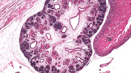 Motivul pentru care cercetătorii britanici au cerut aprobarea pentru a modifica genetic embrioni umani 