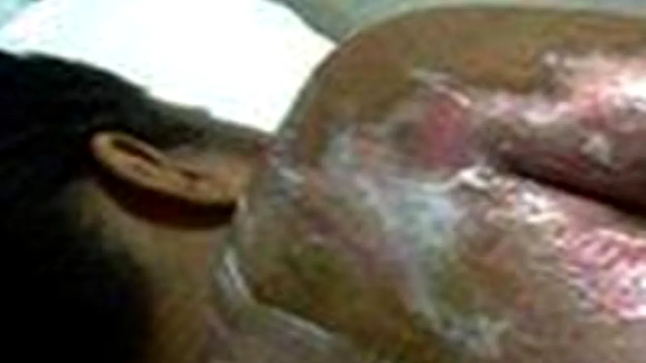 Caz șocant în Arabia Saudită. Menajera a ajuns la spital pentru că nu a făcut cafeaua la timp. Atenție, imagini dure!