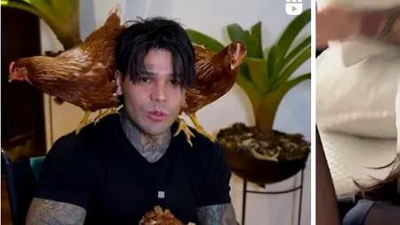 Un influencer a plătit aproape 175.000 dolari pentru „cea mai dureroasă operație posibilă” pentru 15 centimetri în plus