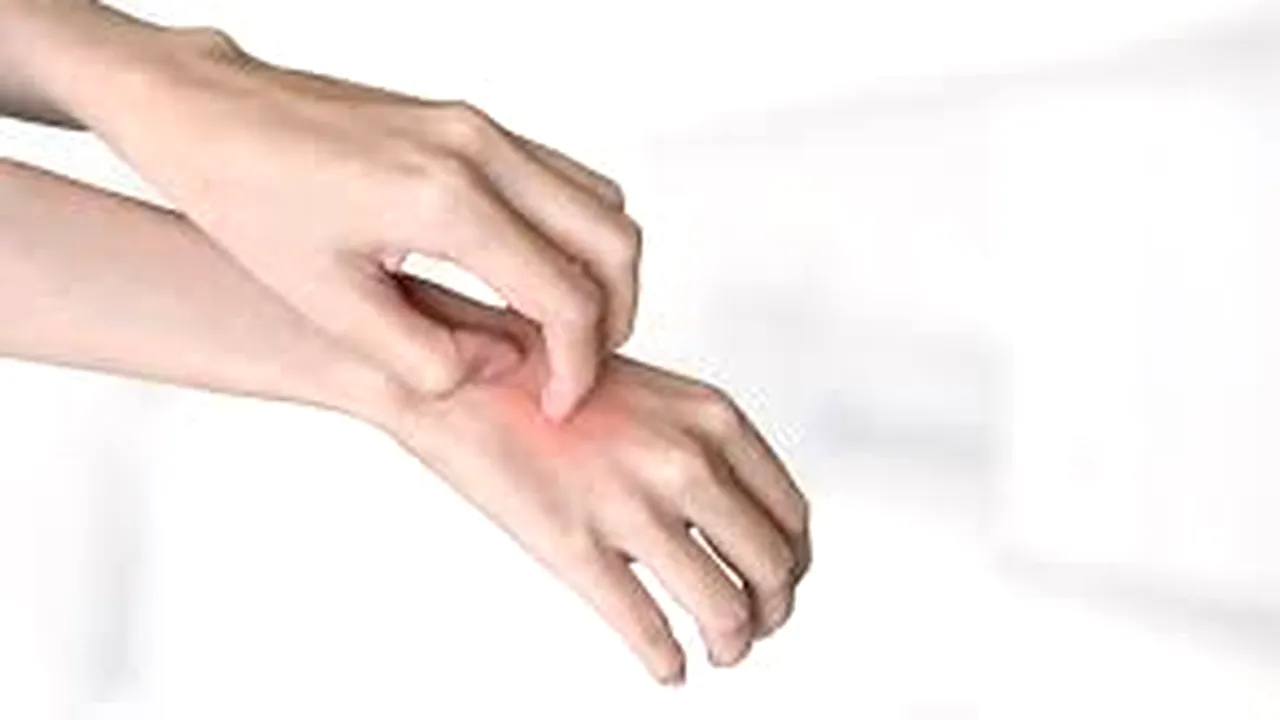 SPANIA. Cinci afecțiuni ale pielii, asociate cu infectarea cu noul coronavirus