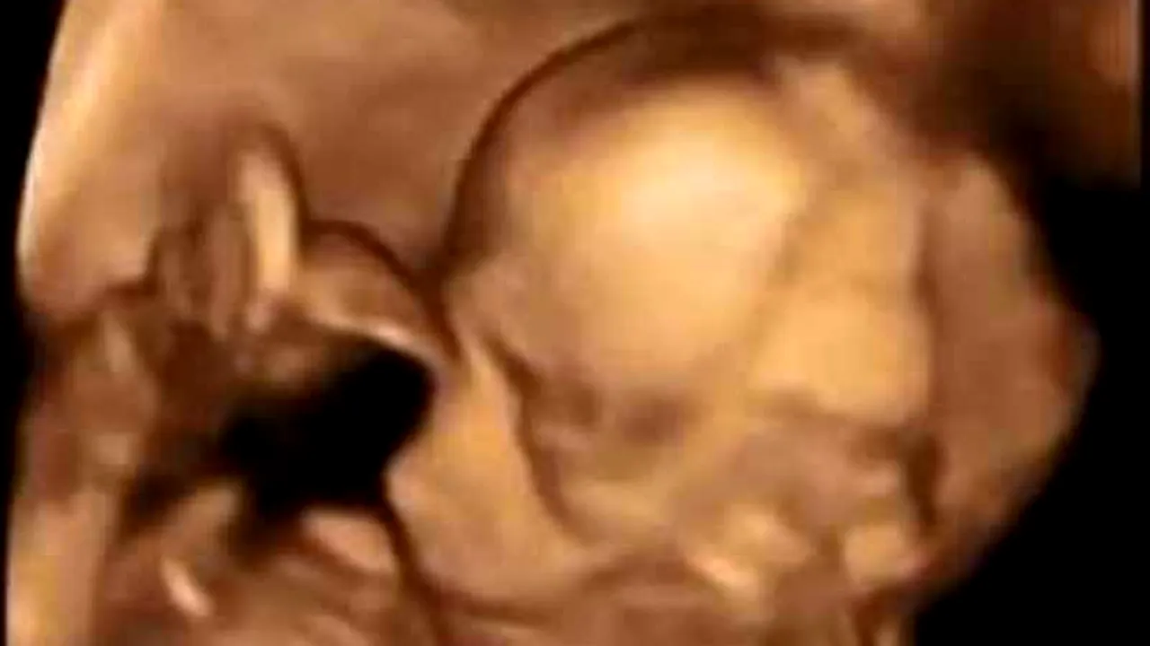 VIDEO. Reacția acestui cuplu la auzul veștii pe care le-a dat-o medicul la ecografie