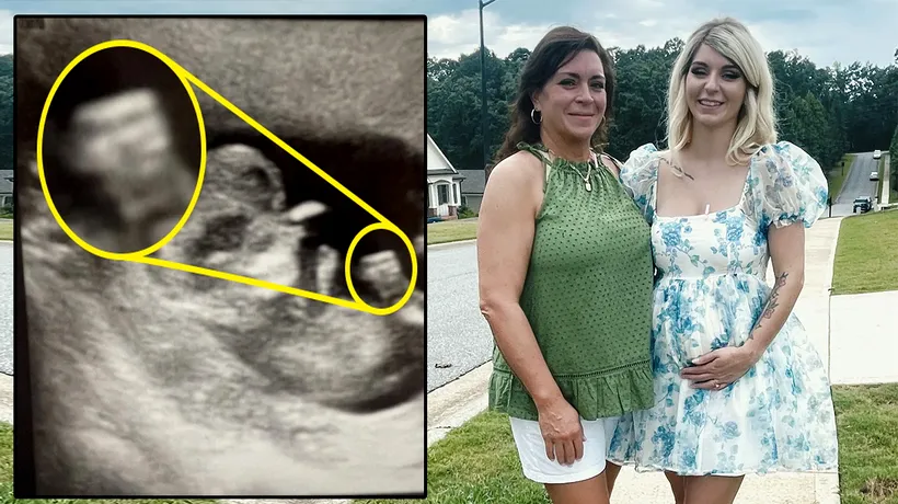 Această femeie gravidă a rămas mască după ce a făcut o ecografie. Detaliul BULVERSANT observat în această imagine