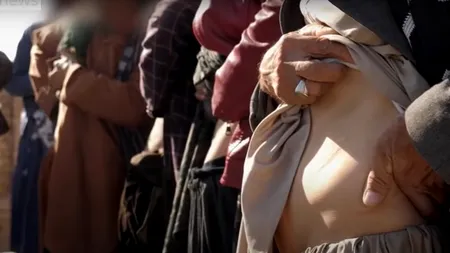 Pentru a nu muri de foame, afganii își vând rinichii în Iran. Familia care a rămas fără organe își vinde acum și copiii