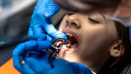 România, codașa Europei la igiena DENTARĂ. Dinți scoși acasă cu patentul, nu la cabinet. De ce ajung românii să se trateze cu leacuri băbești