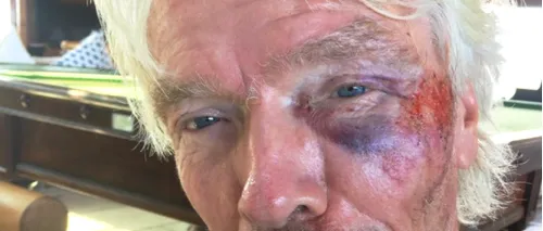 Miliardarul Richard Branson, rănit grav în urma unui accident de bicicletă în Insulele Virgine Britanice. ”Ne-am izbit capetele și corpurile de drumul de beton”