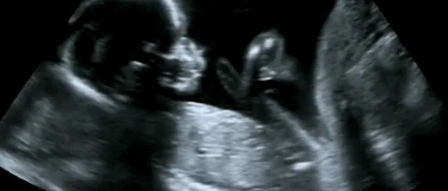 O femeie însărcinată s-a dus să își facă un RMN, dar s-a îngrozit! Imaginile au fost terifiante