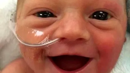 Născut prematur, a fost numit cel mai fericit bebeluș din lume. Fotografia care a emoționat o lume întreagă  