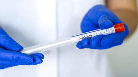 Ministerul Sănătății, sprijin pentru românii care vor să meargă în Grecia. Lista centrelor de testare pentru COVID-19