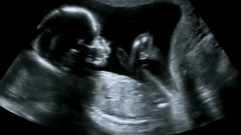 O femeie însărcinată s-a dus să își facă un RMN, dar s-a îngrozit! Imaginile au fost terifiante