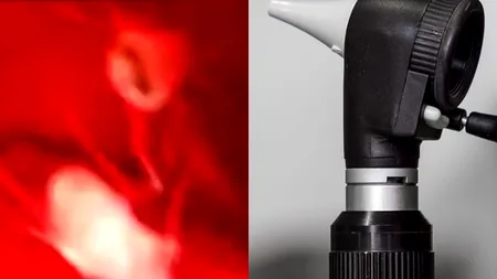 „Aveam o durere cumplită și simțeam că mi se târăște ceva se târăște în ureche. Medicii au rămas șocați de ce au descoperit - VIDEO