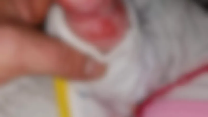 Imagini cu puternic impact emoțional: Un bebeluș s-a ales cu răni grave din cauza unui leucoplast. Micuța era internată în spital pentru răceală
