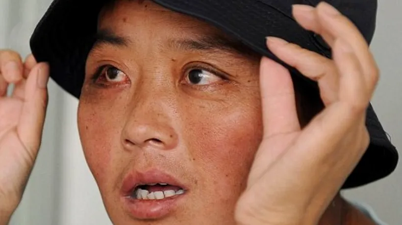 Cum arată o femeie din China înainte ca medicii să-i îndepărteze 70 de tumori de pe față

