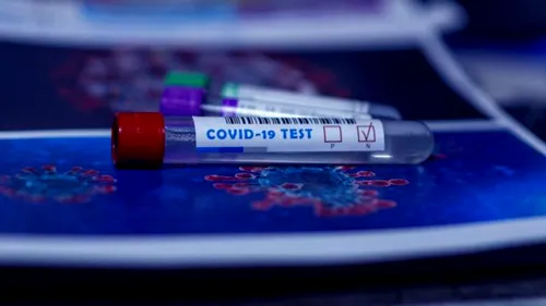 În Irlanda se mai poate intra doar cu test molecular tip PCR negativ! Precizările MAE pentru români