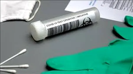 Rusia afirmă că în Orientul Mijlociu au început studiile vaccinului său împotriva coronavirusului