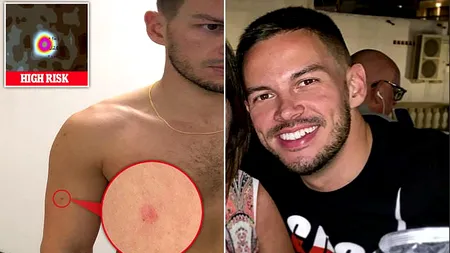 O aplicație l-a avertizat pe un tânăr că suferă de o formă mortală de cancer. Mi-a salvat viața