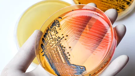 CONTAMINARE. Salmonella, depistată în zeci de tone de carne de pasăre importată din Polonia