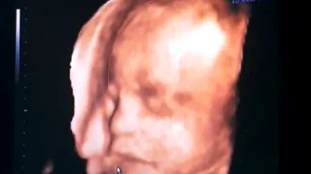 S-a speriat când a văzut cu cine seamănă fiica ei nou-născută. Cum arăta fetița la naștere