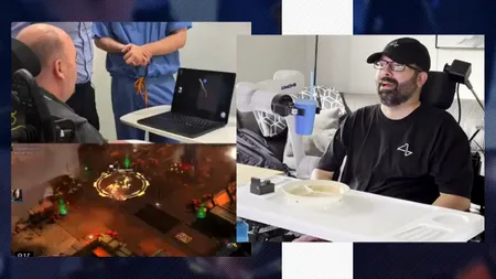 Compania Neuralink a ajuns să implanteze cipuri cerebrale. Cum a transformat un creier uman într-un adevărat joystick