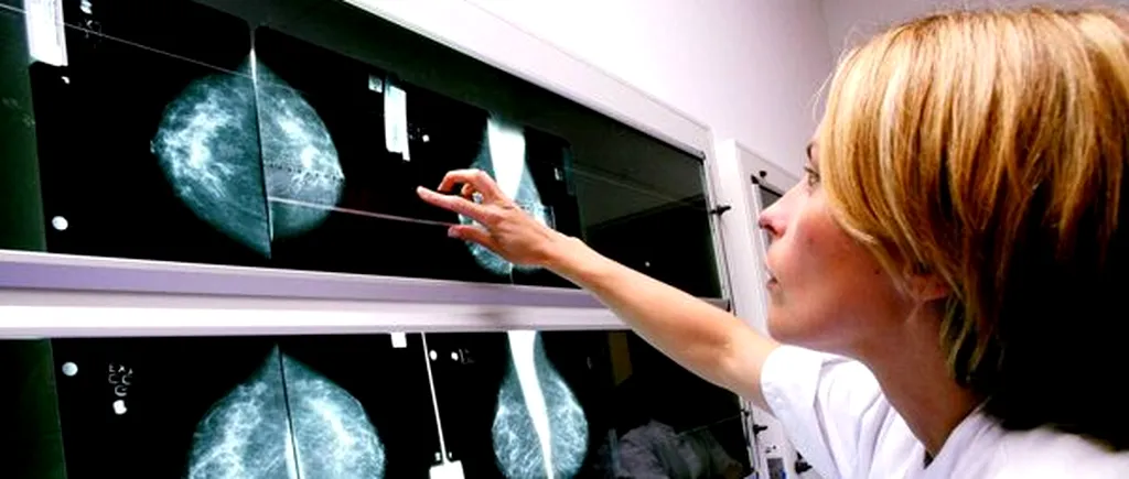 Oncologii se tem că Europa se va confrunta cu o ”epidemie de cancer”. Un milion de cazuri ar fi rămas nediagnosticate în pandemie