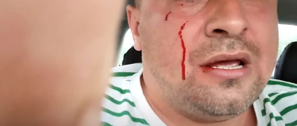VIDEO| Activist din Buzău, bătut de față cu doi polițiști: „Dădeau cu pumnii, cu pietrele. Poliția nu mă proteja cu nimic”