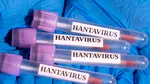 OMS: pasagerii de pe nava de croazieră MV Hondius afectată de hantavirus sunt considerați „contacte cu risc ridicat” și vor fi monitorizați 42 de zile